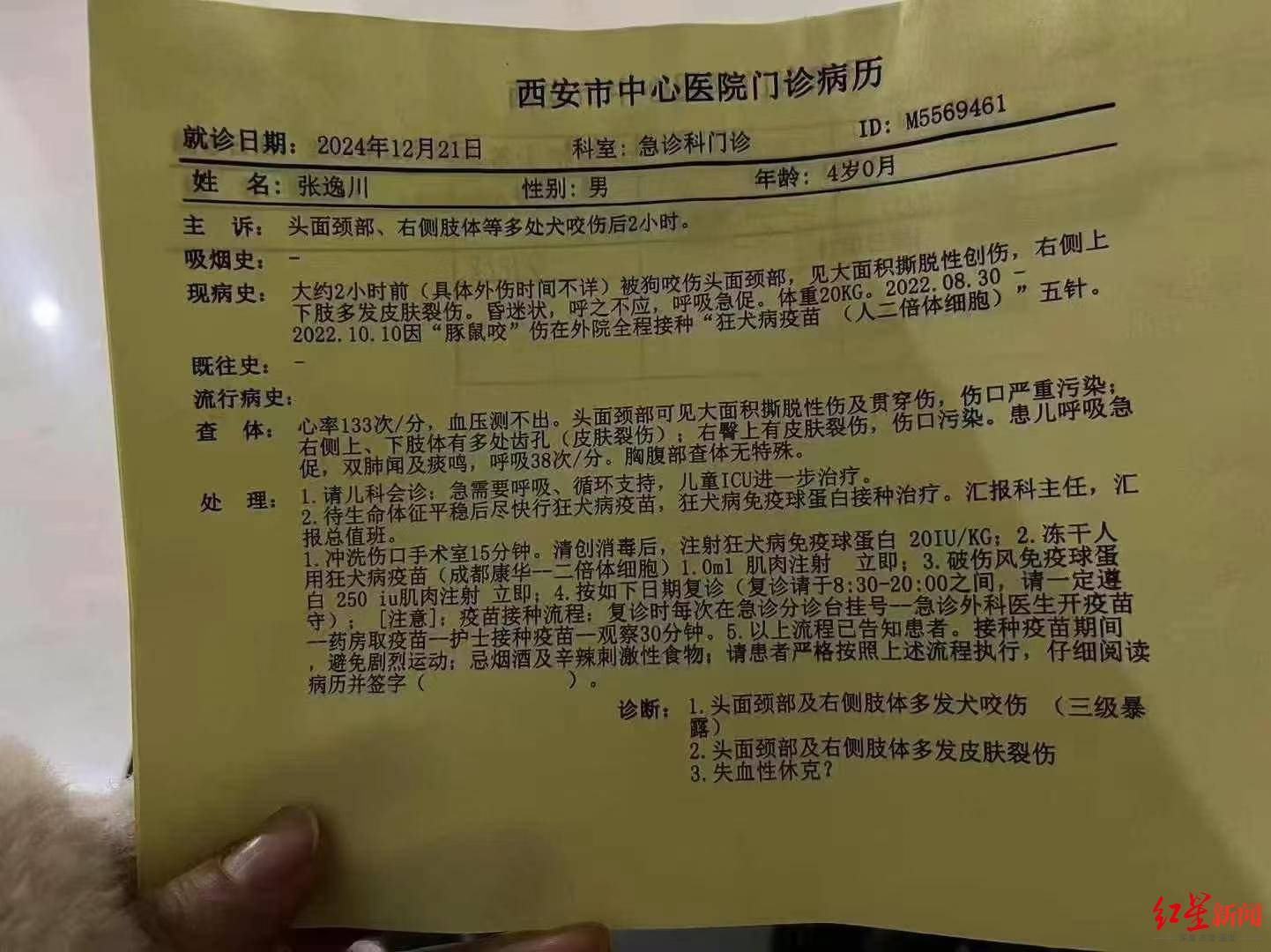 西安4岁男童遭恶犬袭击，致脸部大面积创伤，目前仍在ICU昏迷 警方已在调查犬只来源                