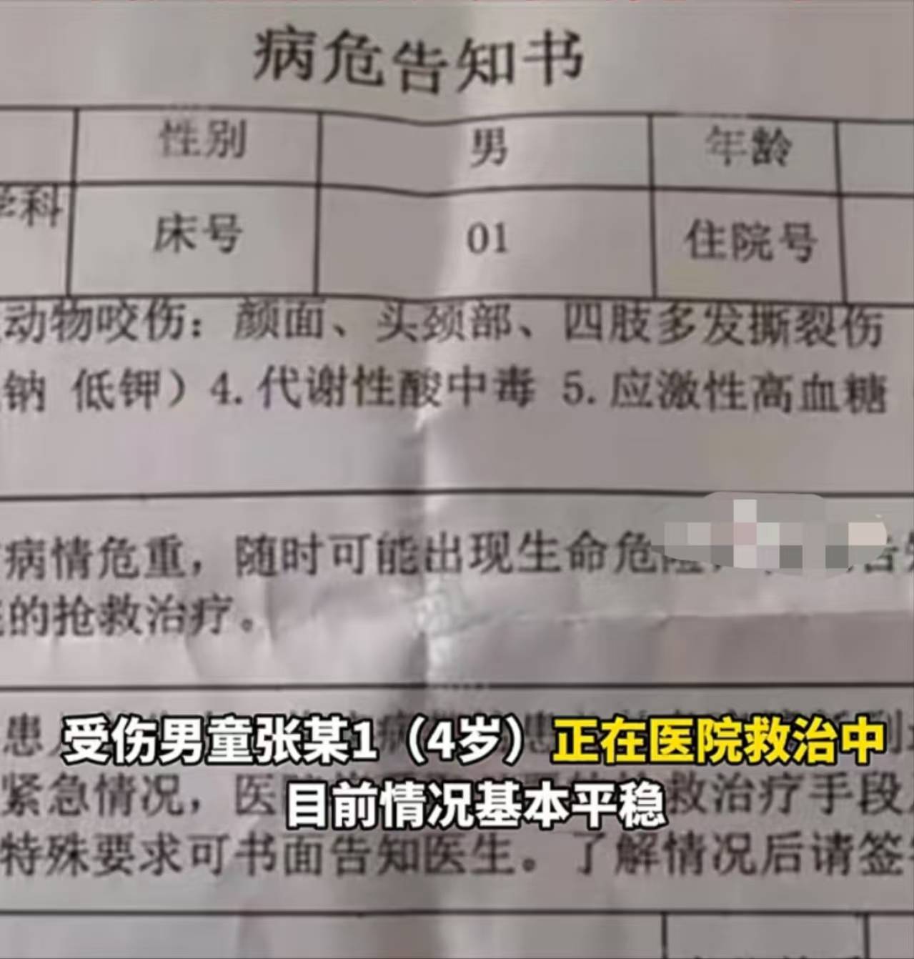 西安4岁男童遭恶犬撕咬，饲养人杀狗藏匿，另一人作假证！专家：量刑时加重处罚！                